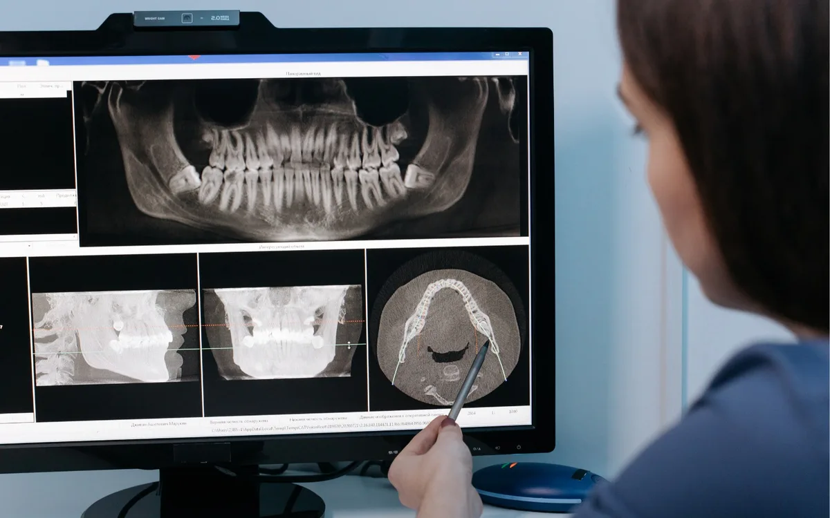 Medic stomatolog utilizând scanner intraoral cu afișaj digital 3D