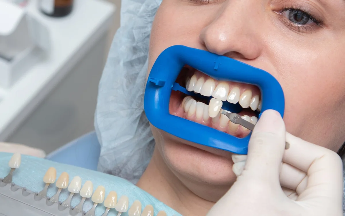 Anxietatea Dentară: Cum o Depășești și de Ce Contează